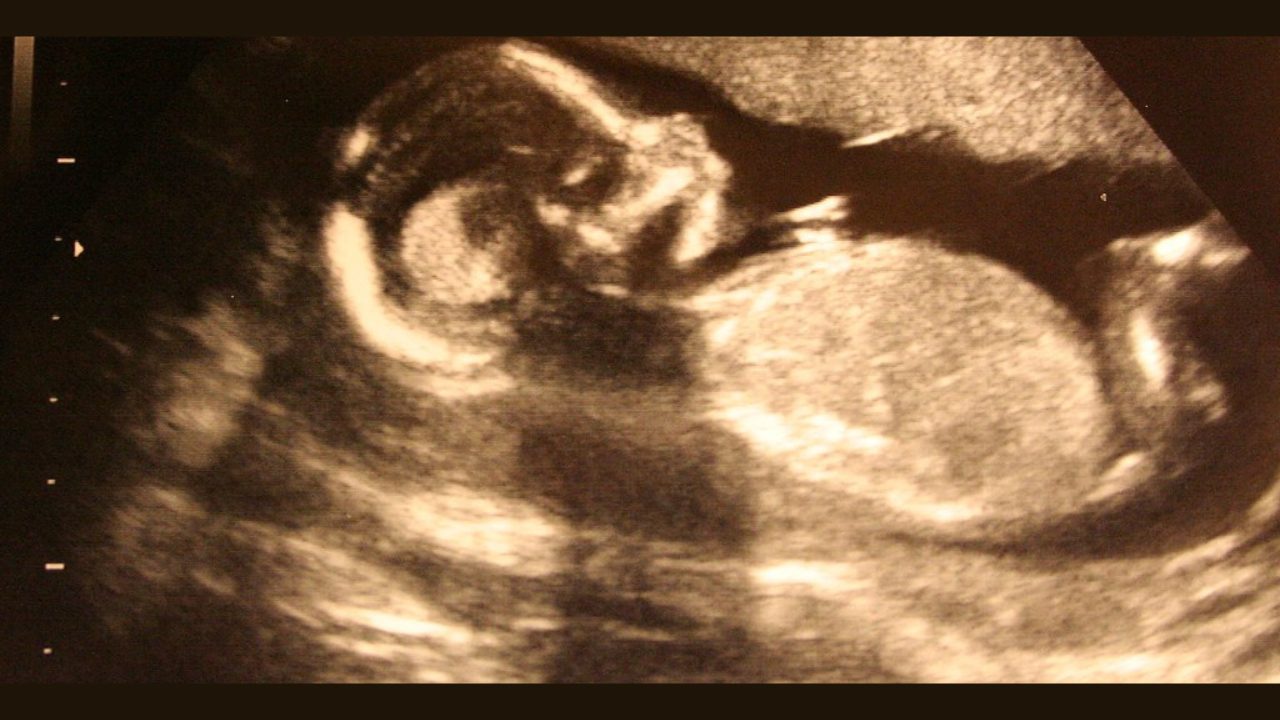 Untitled design - 2024-05-29T142432.088